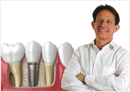 implantes dentales Dr Banchs